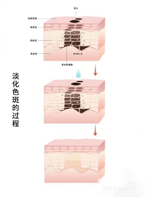 cc彩球网登录入口-美白淡斑精华液哪个牌子比较好？这几款为各种肤质带来美白体验